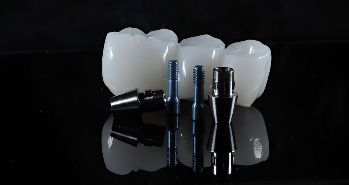 Dental Implants